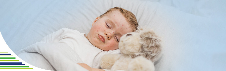 Čo je šiesta choroba a jej príznaky u detí