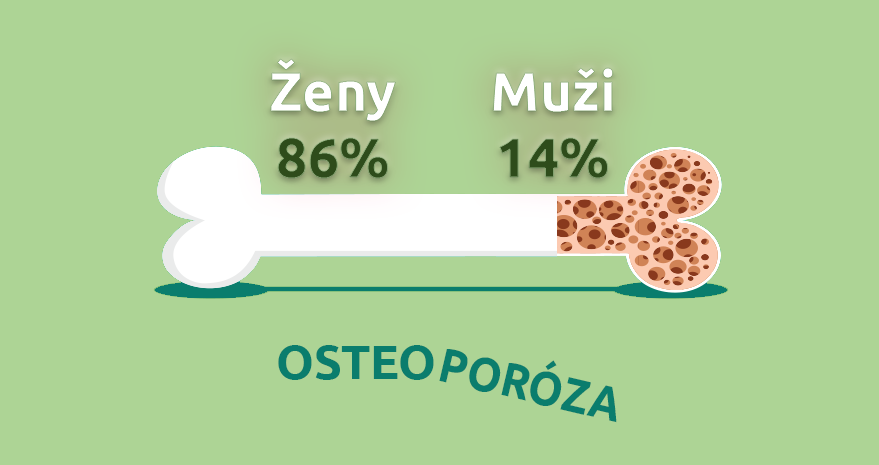 osteoporóza muži ženy