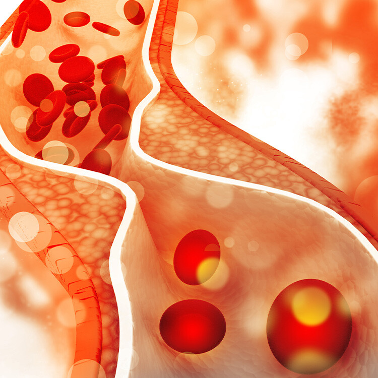 cholesterol v krvi