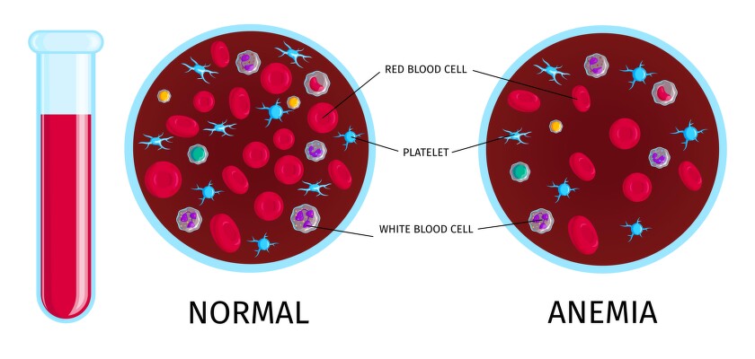 2012.i504.012.blood_cells_anemia[1]