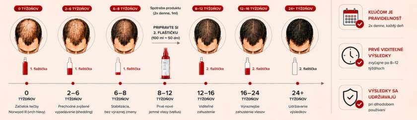 Minoxidil podpora rastu vlasov u mužov