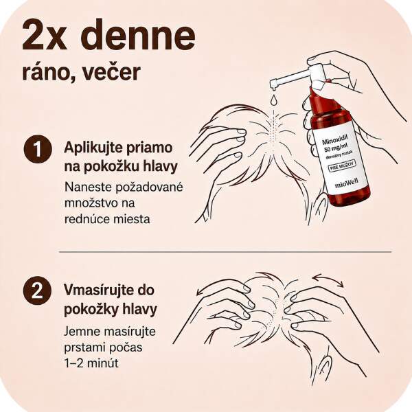 Minoxidil aplikacia