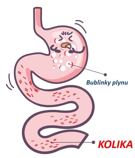 kolika1