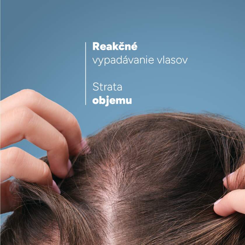 02_DU_ANAPHASE_ANTI-HAIR-LOSS-GROWTH-SHAMPOO_SK
